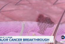 New cancer vaccine shows promise in extending life span in late-stage trial